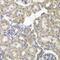 GDH antibody, GTX54162, GeneTex, Immunohistochemistry paraffin image 