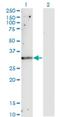 TIMP Metallopeptidase Inhibitor 1 antibody, H00007076-M01, Novus Biologicals, Western Blot image 