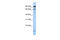 MSL Complex Subunit 2 antibody, 25-839, ProSci, Enzyme Linked Immunosorbent Assay image 