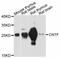 Ciliary Neurotrophic Factor antibody, A11827, ABclonal Technology, Western Blot image 