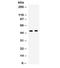 TNF Receptor Superfamily Member 4 antibody, R32104, NSJ Bioreagents, Western Blot image 