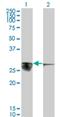 Calcyclin Binding Protein antibody, H00027101-M01, Novus Biologicals, Western Blot image 