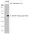 Sequestosome 1 antibody, GTX128171, GeneTex, Western Blot image 