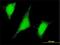 Ubiquitin Conjugating Enzyme E2 W antibody, H00055284-M01, Novus Biologicals, Immunocytochemistry image 