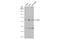 AKT Serine/Threonine Kinase 3 antibody, GTX113312, GeneTex, Western Blot image 