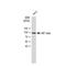 Aryl Hydrocarbon Receptor Nuclear Translocator antibody, GTX00799, GeneTex, Western Blot image 