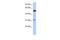 Cytochrome P450 Family 4 Subfamily X Member 1 antibody, GTX45204, GeneTex, Western Blot image 