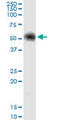 Glucose-6-Phosphate Dehydrogenase antibody, LS-C197258, Lifespan Biosciences, Western Blot image 