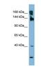 WNK Lysine Deficient Protein Kinase 3 antibody, NBP1-58361, Novus Biologicals, Western Blot image 