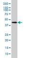 Heat Shock Transcription Factor Family, X-Linked 2 antibody, MA5-21924, Invitrogen Antibodies, Western Blot image 