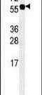 Adenylosuccinate Synthase Like 1 antibody, PA5-25767, Invitrogen Antibodies, Western Blot image 