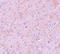 Protein Inhibitor Of Activated STAT 2 antibody, A04130, Boster Biological Technology, Immunohistochemistry paraffin image 