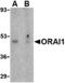 Calcium release-activated calcium channel protein 1 antibody, A00909-1, Boster Biological Technology, Western Blot image 