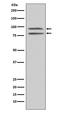 Ribosomal Protein S6 Kinase A5 antibody, P04922, Boster Biological Technology, Western Blot image 