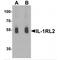 Interleukin 1 Receptor Like 2 antibody, MBS153514, MyBioSource, Western Blot image 