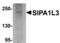 Signal Induced Proliferation Associated 1 Like 3 antibody, TA306878, Origene, Western Blot image 