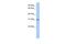 Outer Dense Fiber Of Sperm Tails 3 Like 1 antibody, PA5-69939, Invitrogen Antibodies, Western Blot image 