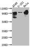 Phosphodiesterase 4D antibody, CSB-RA996952A0HU, Cusabio, Western Blot image 