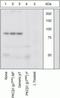 Protein Kinase C Beta antibody, GTX25782, GeneTex, Western Blot image 