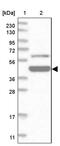 Zinc Finger And BTB Domain Containing 9 antibody, PA5-57804, Invitrogen Antibodies, Western Blot image 