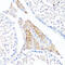 Fibronectin 1 antibody, 16-709, ProSci, Immunohistochemistry paraffin image 