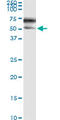Serpin Family A Member 3 antibody, LS-B5371, Lifespan Biosciences, Immunoprecipitation image 
