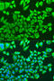 Protein Kinase AMP-Activated Non-Catalytic Subunit Beta 1 antibody, A15708, ABclonal Technology, Western Blot image 