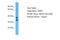 Olfactory Receptor Family 8 Subfamily H Member 1 antibody, A17586, Boster Biological Technology, Western Blot image 