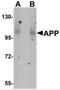 Amyloid Beta Precursor Protein antibody, 5129, ProSci Inc, Western Blot image 