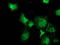 Musashi RNA Binding Protein 1 antibody, TA502252, Origene, Immunofluorescence image 