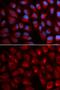 Erythrocyte Membrane Protein Band 4.1 antibody, GTX54005, GeneTex, Immunocytochemistry image 