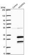 Motile sperm domain-containing protein 3 antibody, PA5-59443, Invitrogen Antibodies, Western Blot image 