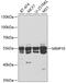 Matrix Metallopeptidase 10 antibody, GTX64385, GeneTex, Western Blot image 