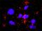 SMAD Family Member 3 antibody, H00004088-M02, Novus Biologicals, Proximity Ligation Assay image 