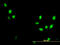 Cyclin Dependent Kinase 1 antibody, LS-C133063, Lifespan Biosciences, Immunofluorescence image 