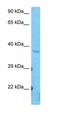 Protein-L-Isoaspartate (D-Aspartate) O-Methyltransferase Domain Containing 2 antibody, orb325423, Biorbyt, Western Blot image 