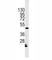 Integrin Linked Kinase antibody, F50637-0.4ML, NSJ Bioreagents, Western Blot image 