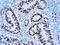 MutS Homolog 6 antibody, GTX73803, GeneTex, Immunohistochemistry paraffin image 