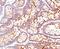 Carcinoembryonic Antigen Related Cell Adhesion Molecule 5 antibody, 33-111, ProSci, Immunohistochemistry frozen image 