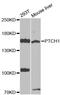 Patched 1 antibody, A0826, ABclonal Technology, Western Blot image 