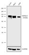 Phosphatidylinositol-4-Phosphate 5-Kinase Type 1 Gamma antibody, 702444, Invitrogen Antibodies, Western Blot image 