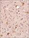 Family With Sequence Similarity 3 Member C antibody, NBP2-24464, Novus Biologicals, Immunohistochemistry paraffin image 