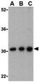 B Cell Receptor Associated Protein 31 antibody, GTX31725, GeneTex, Western Blot image 