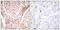 Checkpoint Kinase 2 antibody, LS-C198798, Lifespan Biosciences, Immunohistochemistry frozen image 
