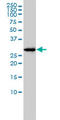 LRAT Domain Containing 1 antibody, LS-C105206, Lifespan Biosciences, Western Blot image 