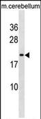 Protein lin-7 homolog B antibody, PA5-72142, Invitrogen Antibodies, Western Blot image 