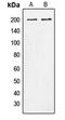 Tensin 1 antibody, LS-C352950, Lifespan Biosciences, Western Blot image 