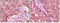 Glycogen Synthase Kinase 3 Alpha antibody, M03152, Boster Biological Technology, Immunohistochemistry paraffin image 