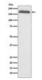 Alpha-2-macroglobulin antibody, M01498, Boster Biological Technology, Western Blot image 