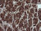 Tripartite Motif Containing 44 antibody, M11544, Boster Biological Technology, Immunohistochemistry paraffin image 